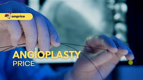 Angioplasty Price in the Philippines – Medical Pinas.